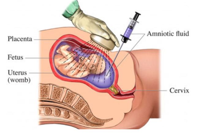 فحوصات الحمض النووي